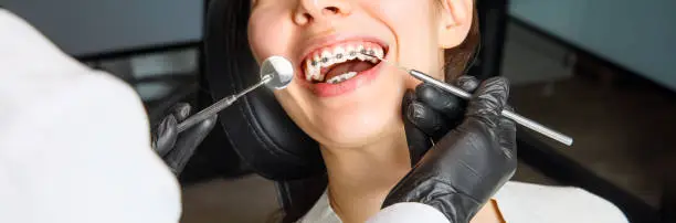 A young woman with metal braces is being examined by an orthodontist. Correction of the bite of teeth in the dental clinic. Concept of healthy teeth