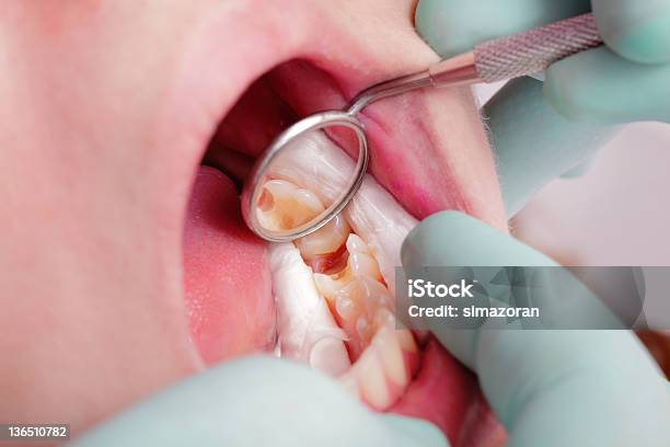 Dental Stock Photo - Download Image Now - Angled Mirror, Close-up, Color Image