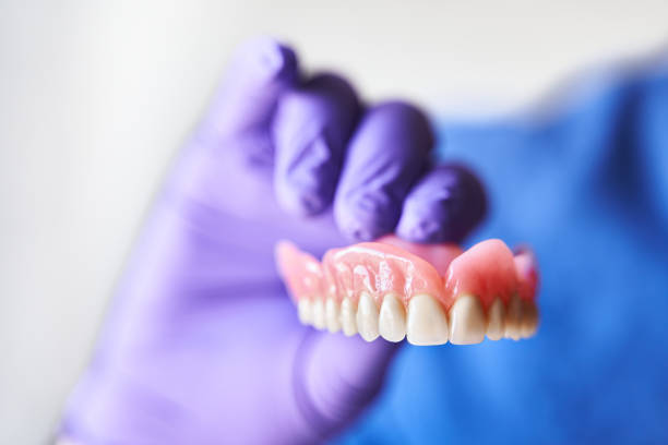 손에 틀니를 들고 보라색 장갑 치과 의사. 치과 보철 및 치과 건강의 개념. - dentures 뉴스 사진 이미지