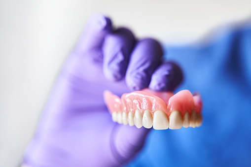 Dentist with purple gloves holding dentures in hand. Concept of dental prosthesis and dental health.