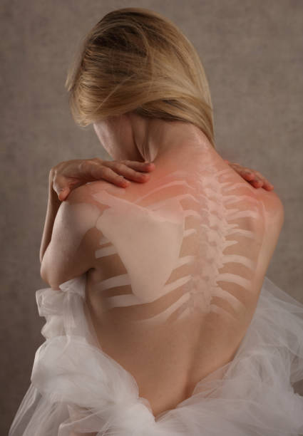 istock Woman suffering from upper back pain . Chiropractic, Physiotherapy Concept. 1365229521