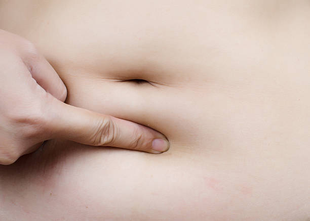 graisse de l'estomac partie du corps féminine. - overweight women abdomen pot belly photos et images de collection