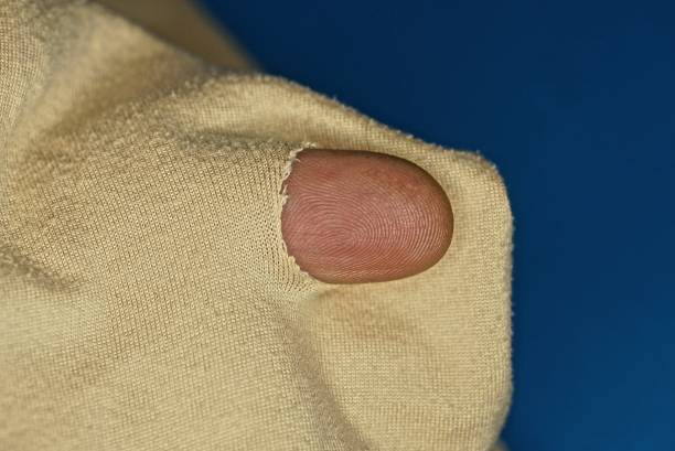 istock one finger in a hole in torn brown fabric of old clothes 1365315802