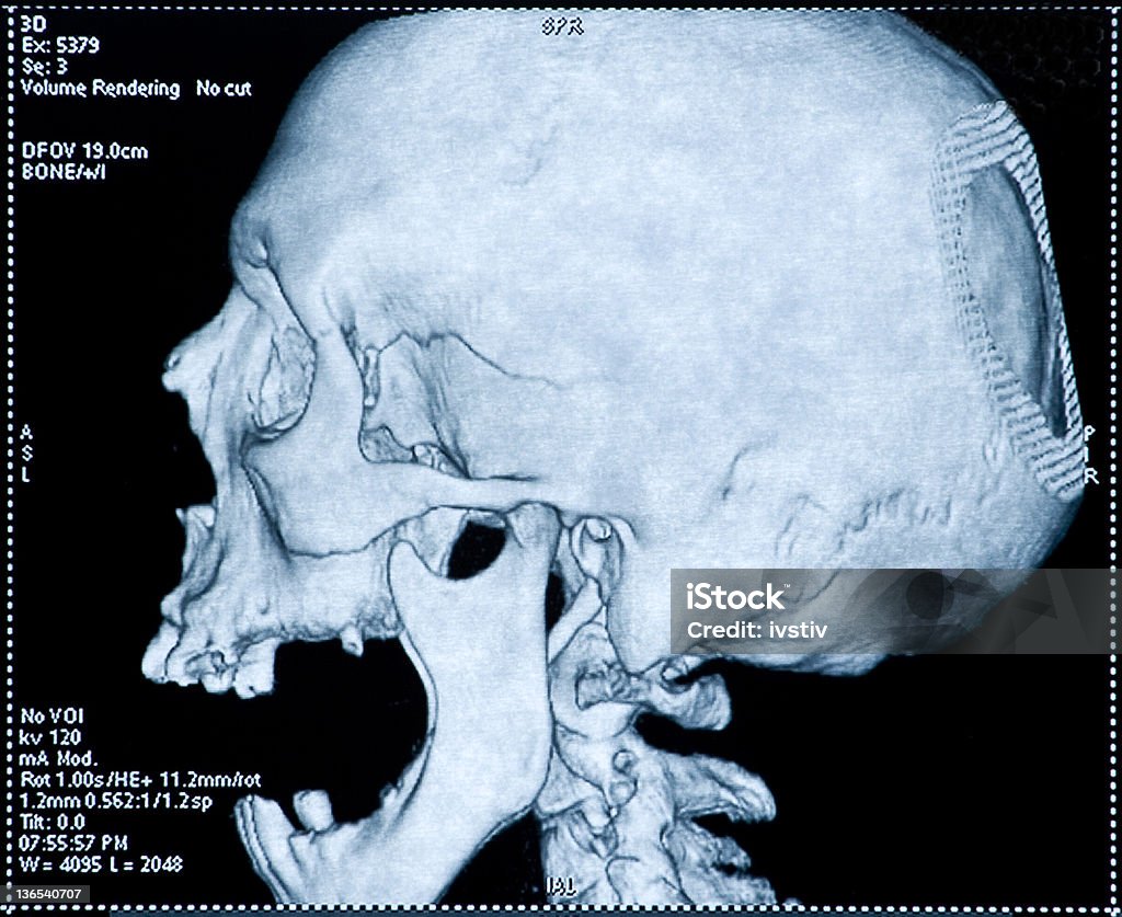 Tomography computadorizada - Foto de stock de Adulto royalty-free