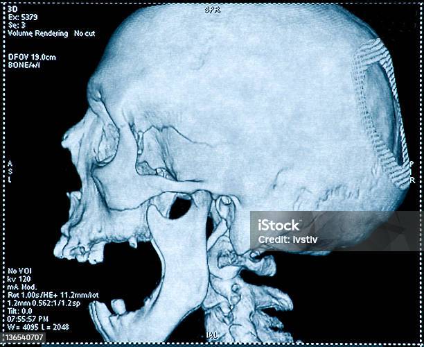 Tomografia Computerized - Fotografias de stock e mais imagens de Adulto - Adulto, Anatomia, Arruinado