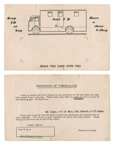 istock Old British tuberculosis chest screening card c1950s-60s 1365434238