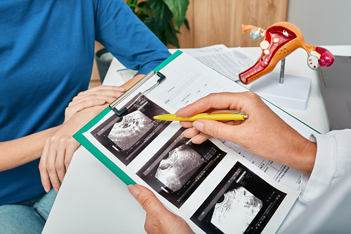 Ginecólogo que muestra a la mujer una ecografía de sus ovarios durante la visita de la paciente femenina a la ginecología para un chequeo médico. Ginecología, consulta de ginecólogo, salud de la mujer photo