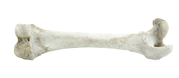 This is a bone. 