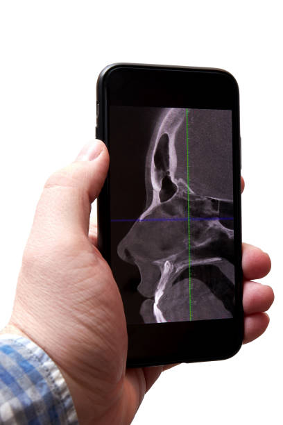 istock Young man analyzing an x-ray scan of his head on a phone 1365540505