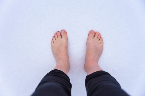 Female person, top view, cold, winter, leg, toes, white