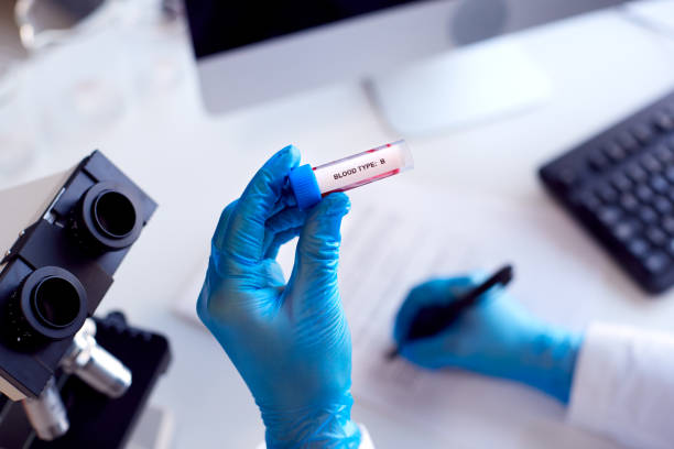 혈액 샘플을 들고 현미경을 사용하여 연구를 수행하는 실험실 노동자의 닫기 유형 b - group b 뉴스 사진 이미지
