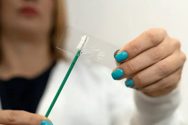 Photo of Doctor performing a cervical uterine cytology. Gynecology and health concept.