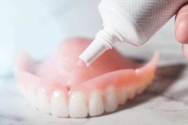 Denture Cream being applied to dentures stock photo