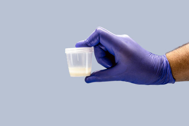 hand using Nitrile glove for male semen or sperm collection, semen donation concept hand using Nitrile glove for male semen or sperm collection, semen donation concept sperm stock pictures, royalty-free photos & images