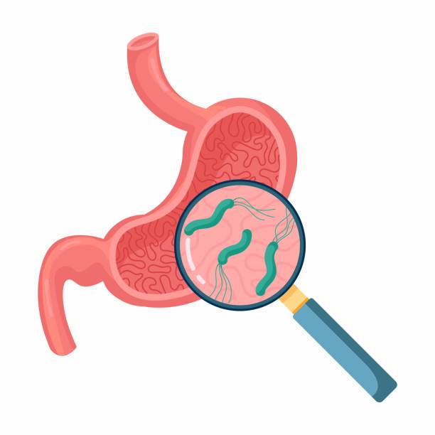 illustrazioni stock, clip art, cartoni animati e icone di tendenza di elicobacter pylori nello stomaco. malattie dello stomaco. batterio con flagelli che causa gastrite. - piloro