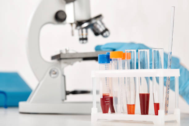 istock stand with test tubes with blood and solutions on the background of a microscope 1365921834