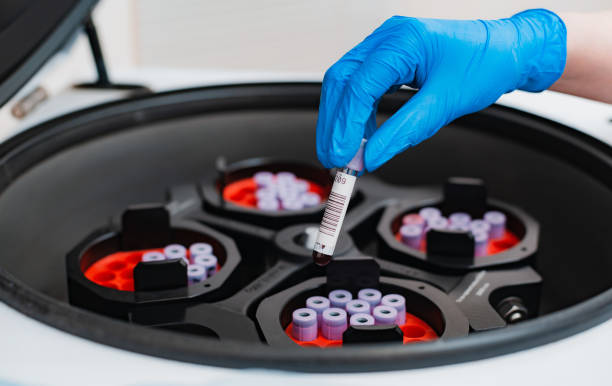 A test tube with blood tests is placed in a centrifuge with a hand in a blue rubber glove A test tube with blood tests is placed in a centrifuge with a hand in a blue rubber glove human centrifuge stock pictures, royalty-free photos & images