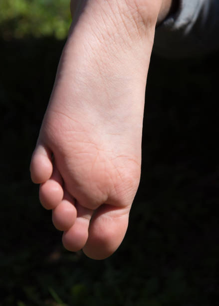 istock Small child foot with toes 1366231474