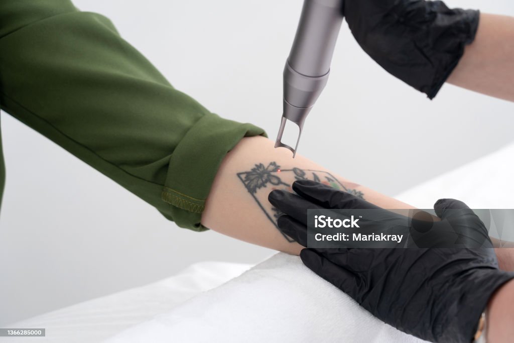 Beautician using laser device to remove an unwanted tattoo from female arm. Concept of erasing tattoos as an expensive procedure in a cosmetology clinic Beautician using laser device to remove an unwanted tattoo from female arm. Concept of erasing tattoos as expensive procedure in a cosmetology clinic Tattoo Stock Photo