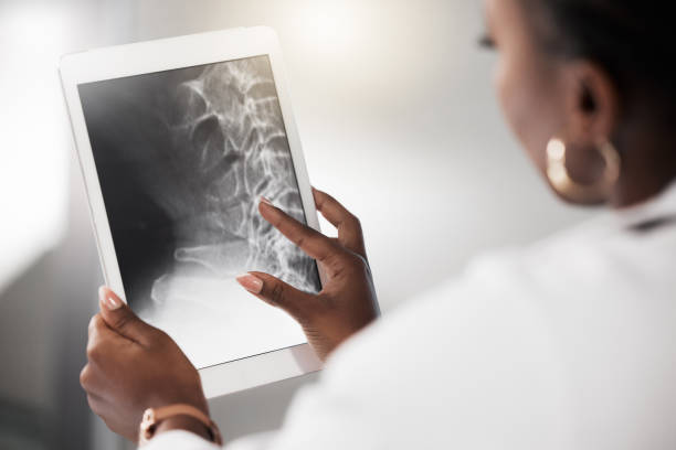 aufnahme eines arztes, der eine röntgenaufnahme auf dem bildschirm eines digitalen tablets analysiert - osteoporose stock-fotos und bilder