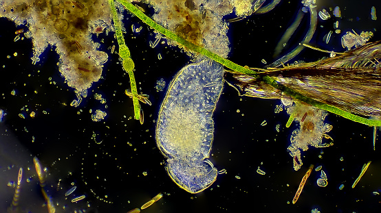 Planaria worm in pond water