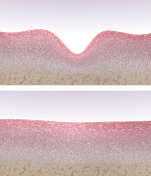 hình minh họa 3d mặt cắt ngang da nhăn nheo và mịn màng - thắt chặt bức ảnh hình ảnh sẵn có, bức ảnh & hình ảnh trả phí bản quyền một lần