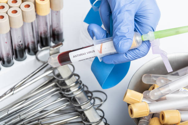 istock Scientists hand holding a test-tube with blood sample for ANTHRAX VIRUS test. 1366736920