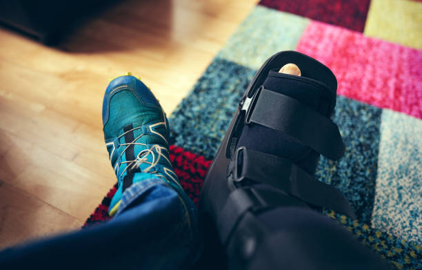 7,600+ Broken Ankle Stock Photos, Pictures & Royalty-Free Images - iStock