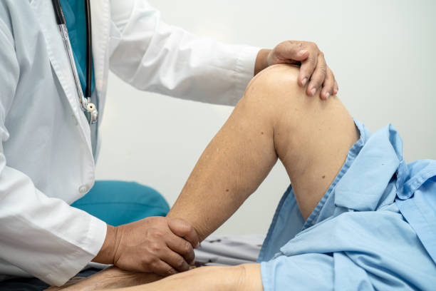 asian doctor physiotherapist examining, massaging and treatment knee and leg of senior patient in orthopedist medical clinic nurse hospital. - physical checkup imagens e fotografias de stock