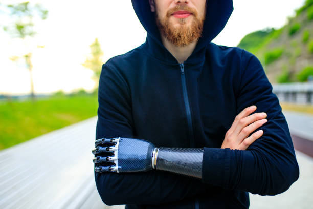 man with arm prosthesis in sports clothing ready for morning workout outdoors. disabled sport concept - paralympic games prosthetic equipment amputee athlete imagens e fotografias de stock