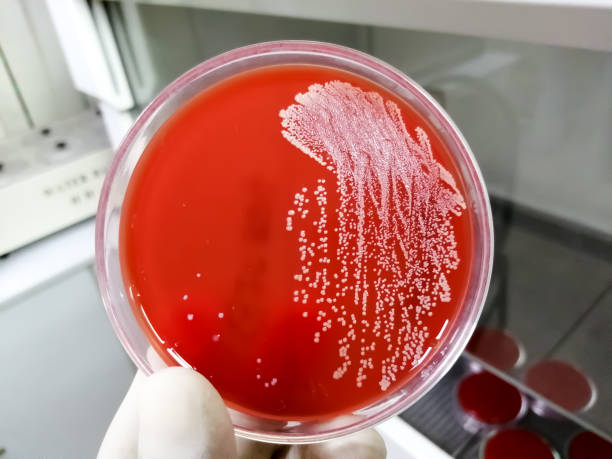 staphylococcus aureus: gram positive bakterien - blood agar stock-fotos und bilder