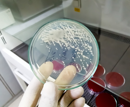 Close-up of gram-negative bacteria growth on HiCrome UTI Agar with white scientist hand holding