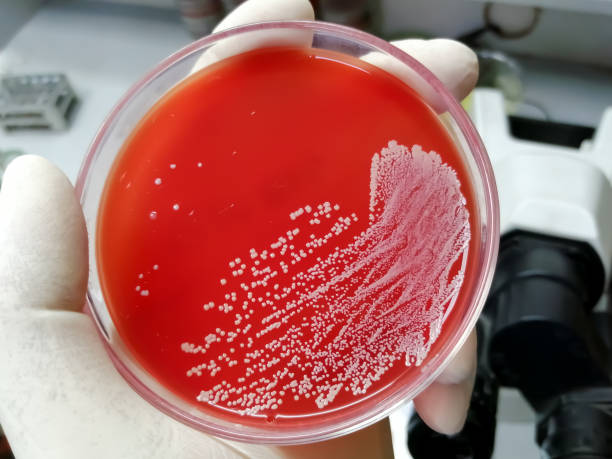 Staphylococcus aureus: Gram-positive, to Gram-variable, saprotrophic bacterium that belongs to the family Staphylococcus growth on blood agar. Staphylococcus aureus: Gram-positive, to Gram-variable, saprotrophic bacterium that belongs to the family Staphylococcus growth on blood agar. aureus stock pictures, royalty-free photos & images