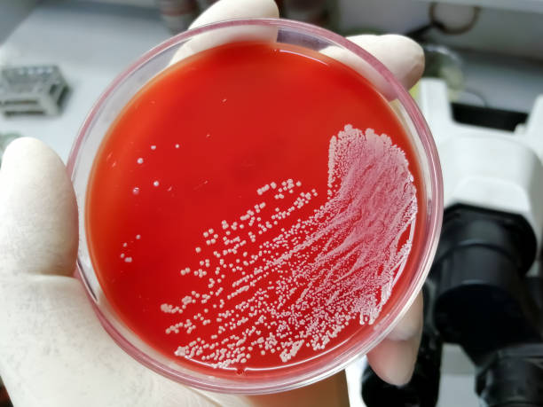 staphylococcus aureus: gram-dodatnia, do gram-zmiennej, saprotroficzna bakteria, która należy do rodziny staphylococcus wzrost na agarze krwi. - blood agar zdjęcia i obrazy z banku zdjęć