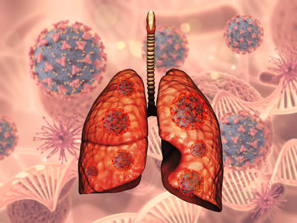 istock 3D medical background with lungs and Covid 19 virus cells 1367050942