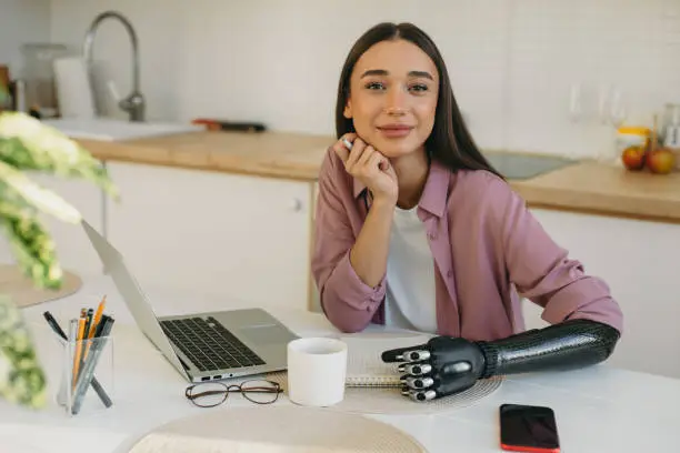 Charming gorgeous adorable photogenic woman with full pouty lips and iron bionic arm prosthesis, holding pen in hand, looking at camera, working at kitchen table, making notes next to laptop and phone