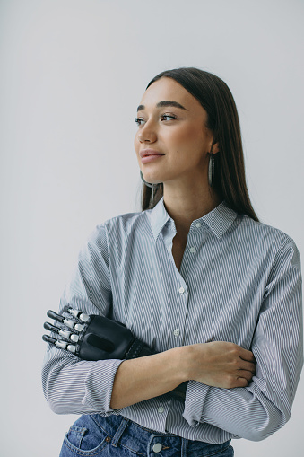 Retrato de estudio interior de un encantador cyborg femenino fotogénico con un brazo protésico artificial altamente desarrollado y cómodo en lugar de una mano después de un accidente. Biotecnología del futuro. Atención sanitaria photo
