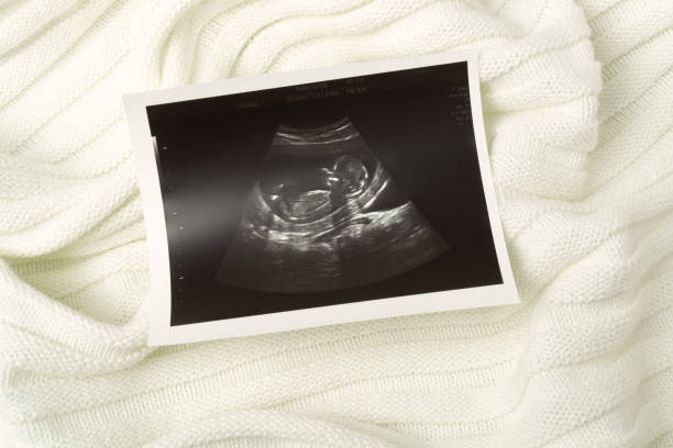 istock Image of baby during ultrasound examination on white soft fabric background. 1367232009