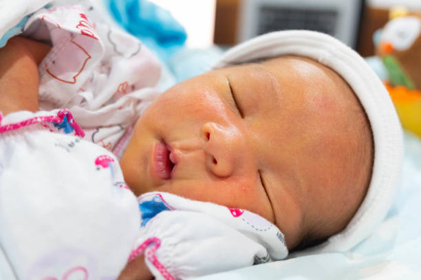 icterícia neonatal cor amarela de pele acontecer em recém-nascido bebê - yellowing - fotografias e filmes do acervo