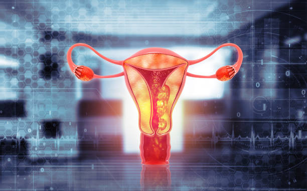 malattie del sistema riproduttivo femminile. cancro dell'utero e tumore maligno dell'endometrio come concetto medico uterino. illustrazione 3d - ovary foto e immagini stock