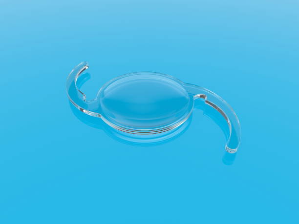 150+ Intraocular Lens Stock Photos, Pictures & Royalty-Free Images - iStock | Cataract, Eye surgery, Cochlear implants