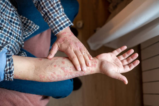 adult skin problem stock photo