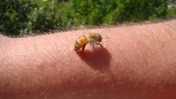 bee : apis mellifera.
treatment by honey bee sting
closeup honey bee stinging a hand.
close up bee worker.
insects, insect, animal, wildlife, wild nature, forest, woods, garden
beauty of pollination abeja : apis mellifera.
tratamiento por picadura de abeja melífera
primer plano abeja melífera picando una mano.
trabajador apícola de cerca.
insectos, insectos, animales, vida silvestre, naturaleza salvaje, bosque, bosque, jardín
belleza de la poliniz