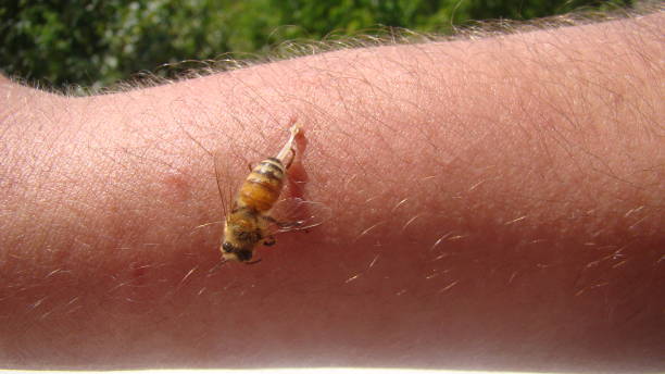 bee : apis mellifera.
treatment by honey bee sting
closeup honey bee stinging a hand.
close up bee worker.
insects, insect, animal, wildlife, wild nature, forest, woods, garden
beauty of pollination abeja : apis mellifera.
tratamiento por picadura de abeja melífera
primer plano abeja melífera picando una mano.
trabajador apícola de cerca.
insectos, insectos, animales, vida silvestre, naturaleza salvaje, bosque, bosque, jardín
belleza de la poliniz