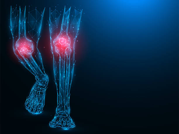 polygonale vektordarstellung von menschlichen beinen, schmerzenden und entzündeten knien. sick knees konzept. arthritis der kniegelenke.. medizinisches banner, vorlage oder hintergrund. - menschliches gelenk stock-grafiken, -clipart, -cartoons und -symbole