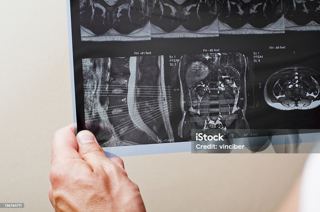 radiography - Lizenzfrei Anatomie Stock-Foto