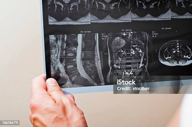 Radiografia - Fotografias de stock e mais imagens de Anatomia - Anatomia, Cartilagem, Coluna vertebral humana