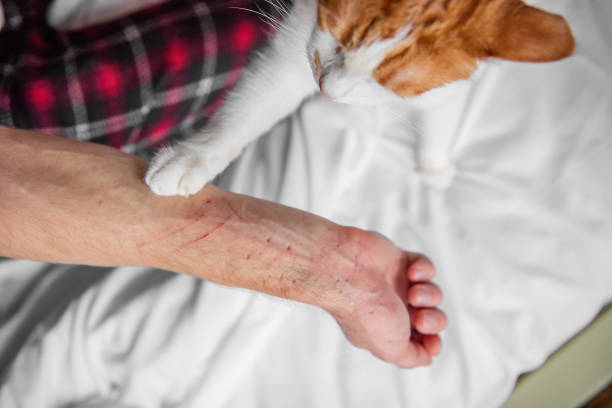 istock Rabid white-red cat furiously scratched, bit through the mans hand until it bled. Pet attack. 1368079372