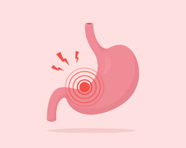 Stomach pain. Gastritis, indigestion, heartburn. Vector illustration of human internal organ. Stomach pain. Gastritis, indigestion, heartburn. Vector illustration of human internal organ. stomach ache illustrations stock illustrations