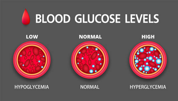 гипергликемия, высокий уровень сахара в крови и диабет, ожирение является серьезным заболеванием причин, вектор дизайна. - blood sugar test stock illustrations